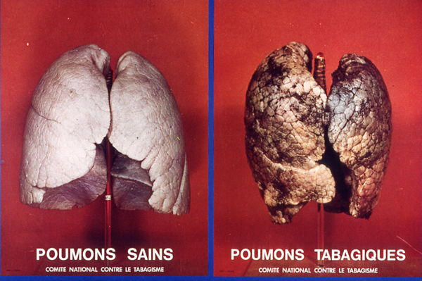 Poumons-sains-poumons-fumeurs-p4